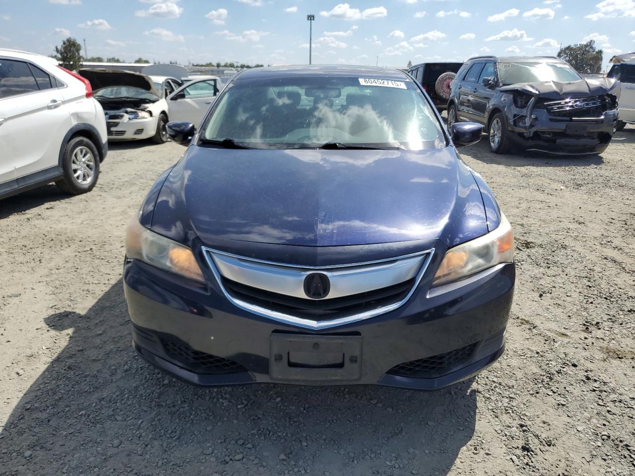 Acura ILX 20 Image 5